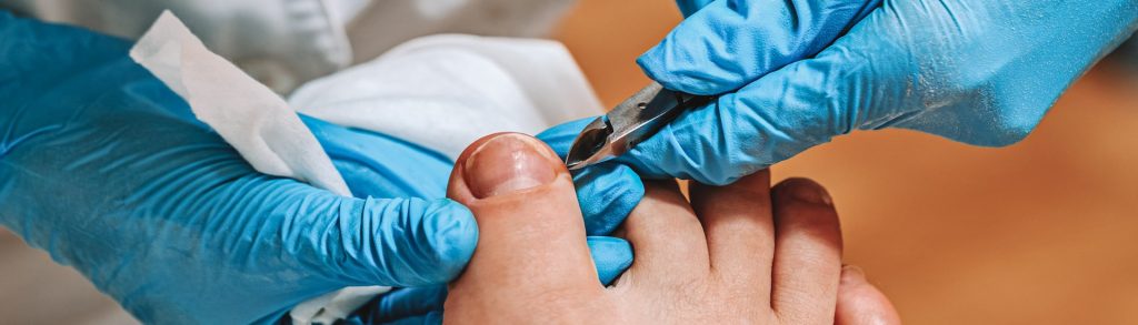 podiatry conditions ingrown toenail